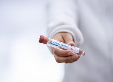 Sitios donde puedes hacerte la prueba de Covid en Edomex para viajar a EU