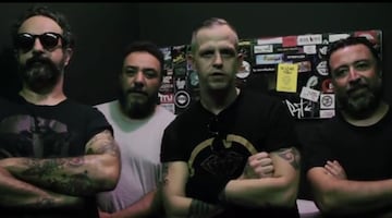 “No es por drogas”: Tito, de Molotov, revela la verdadera razón detrás de sus intervenciones médicas