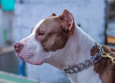 Hombre de Texas muere después de que pitbulls mutilaron sus piernas