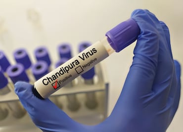 Chandipura, el letal virus qua causa alarma. Síntomas, cómo se transmite. ¿Hay casos en México?