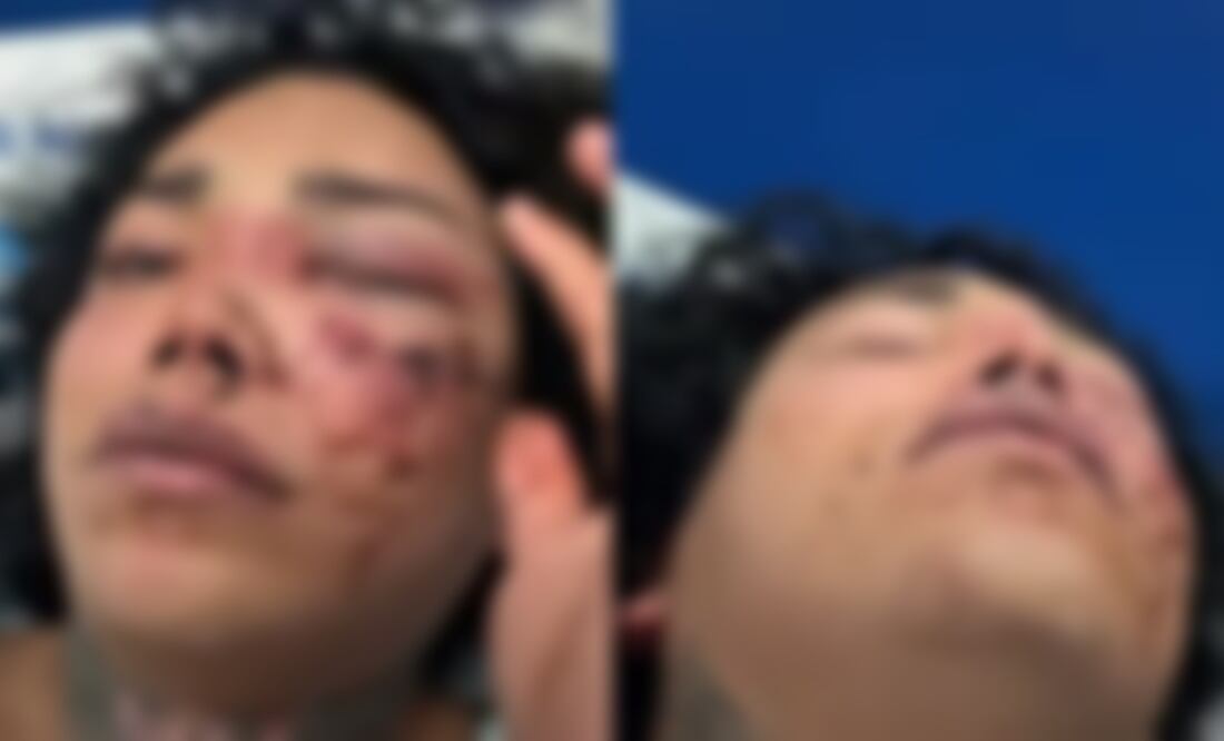 Tras comprometerse, Paola Suárez de ‘Las Perdidas’ sufre brutal golpiza por parte de su novio. Foto Youtube