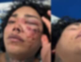 Tras comprometerse, Paola Suárez de ‘Las Perdidas’ sufre brutal golpiza por parte de su novio