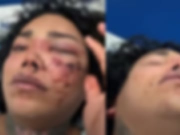 Tras comprometerse, Paola Suárez de ‘Las Perdidas’ sufre brutal golpiza por parte de su novio