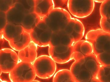 Alertan por brote de enfermedad meningocócica en Florida. ¿Qué es?