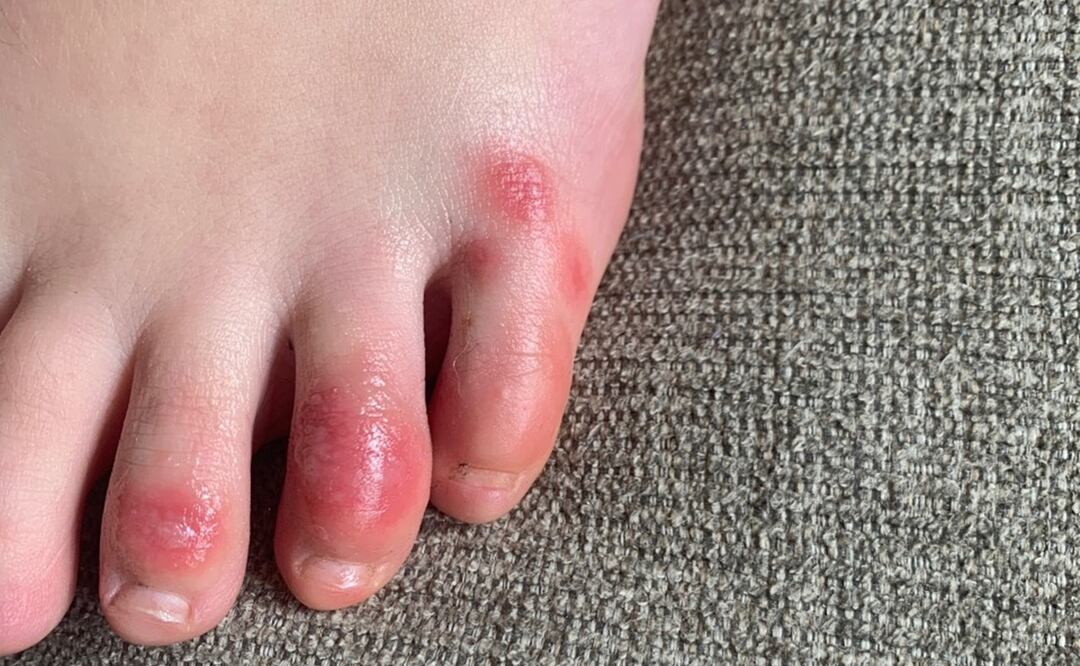 Foto: Northwestern University