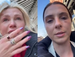 Hombres golpean a mujeres al azar en Nueva York; víctimas narran agresión en TikTok