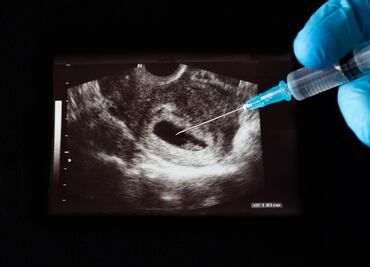 Más de 100,000 abortos en enero en Estados Unidos: efecto de la anulación de Roe contra Wade