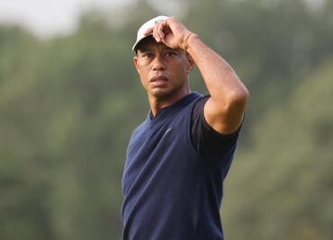 “Tiger Woods tiene suerte de estar vivo”