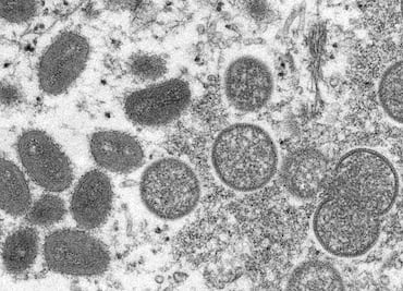 Viruela del mono. OMS repartirá vacunas en más de 30 países