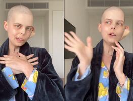 Muere famosa influencer a los 24 años por extraña enfermedad; video de despedida se viraliza