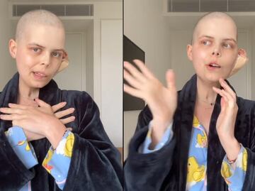 Muere famosa influencer a los 24 años por extraña enfermedad; video de despedida se viraliza