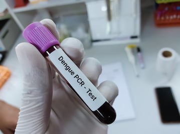 Florida enfrenta su peor brote de dengue en décadas: ¿qué está pasando en Tampa?