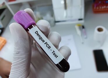 Declaran una epidemia de dengue en Puerto Rico; ¿Qué es, síntomas y cómo se transmite?