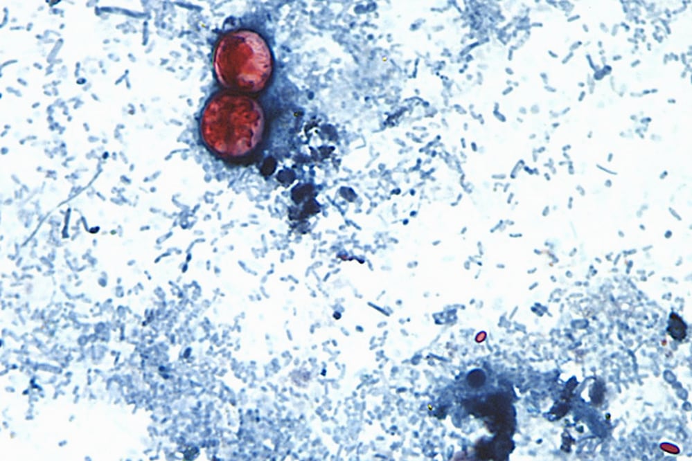 México activa vigilancia epidemiológica por Cyclospora tras confirmar 33 casos; síntomas y cómo se contagia. Foto: (CDC vía AP, Archivo)