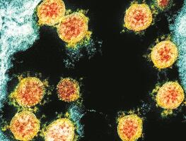 Muere niño por Covid-19 en Minnesota; segundo caso en el estado