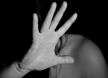 Aumentan asesinatos de albinos durante la pandemia