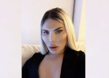 “Ken humano” revierte sus cirugías para ahora ser “Barbie”