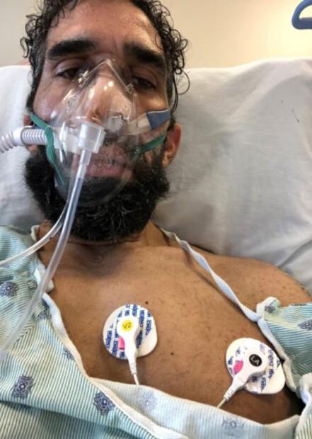 Atleta relata y muestra cómo el coronavirus devastó su cuerpo 