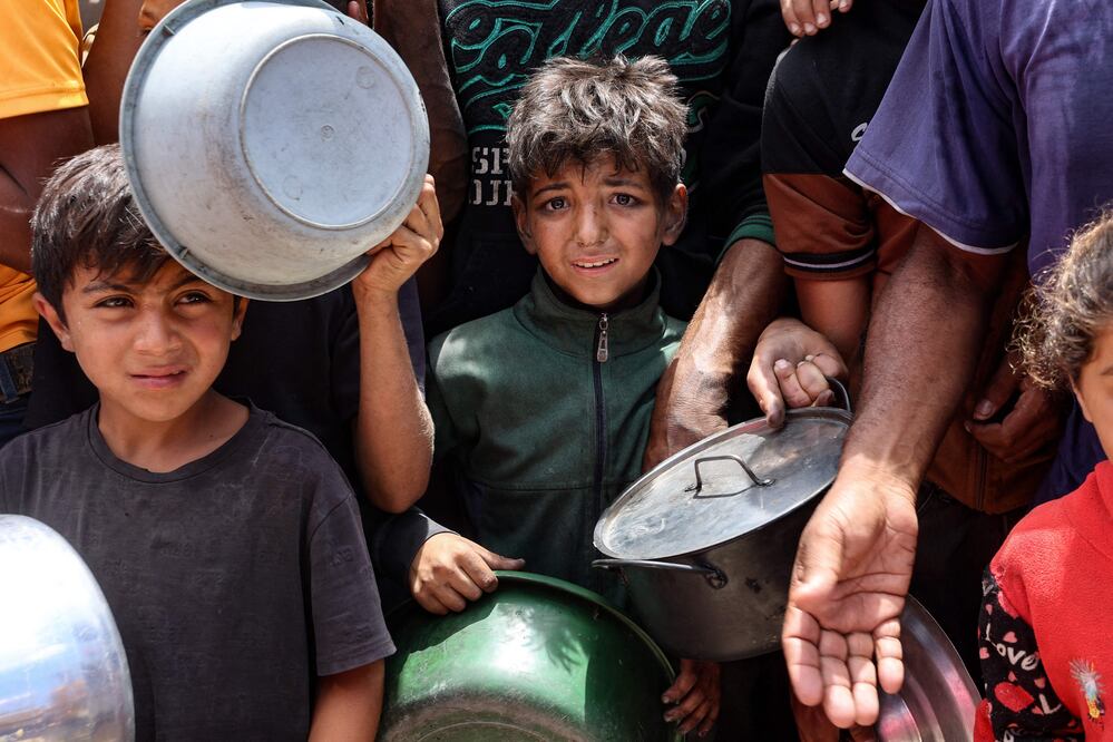 Niños desnutridos y madres desesperadas: Gaza se hunde en una crisis humanitaria(Photo by Omar AL-QATTAA / AFP)