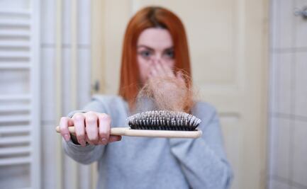 Secuela de Covid-19 y otras razones por las que sufres caída del cabello 