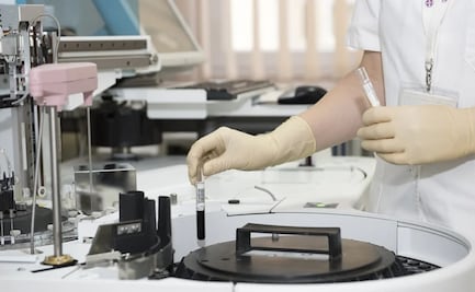 Alerta la OMS: Gripe aviar en gatos podría requerir vacunas para evitar propagación a humanos