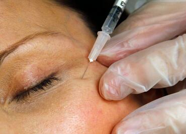 Suman 11 mujeres hospitalizadas en EU por inyecciones falsas de bótox. ¿Cuáles son los síntomas?