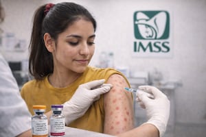 Sarampión en México: ¿La vacuna inmuniza o sólo reduce síntomas? Esto dicen expertos