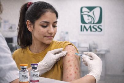 Sarampión en México: ¿La vacuna inmuniza o sólo reduce síntomas? Esto dicen expertos