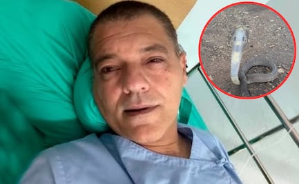 Influencer Frank Cuesta es hospitalizado en Tailandia tras mordedura de una cobra escupidora, una de las más letales