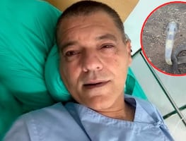 Influencer Frank Cuesta es hospitalizado en Tailandia tras mordedura de una cobra escupidora, una de las más letales