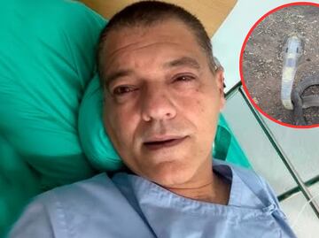 Influencer Frank Cuesta es hospitalizado en Tailandia tras mordedura de una cobra escupidora, una de las más letales
