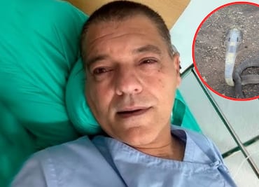 Influencer Frank Cuesta es hospitalizado en Tailandia tras mordedura de una cobra escupidora, una de las más letales