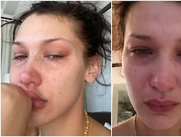 “Las redes sociales no son reales”, Bella Hadid padece depresión y ansiedad