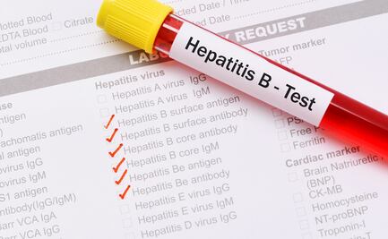 Aumentan los casos de hepatitis B en vecindarios pobres de Nueva York, principalmente