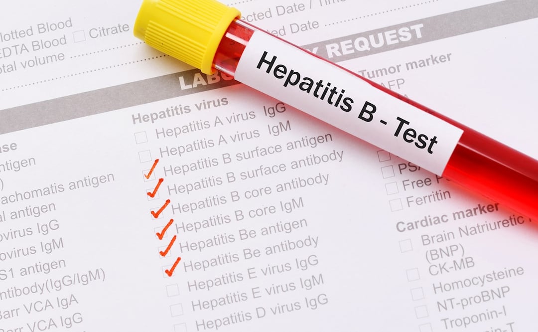 Aumentan los casos de hepatitis B en vecindarios pobres de Nueva York, principalmente. Foto: iStock-jarun011