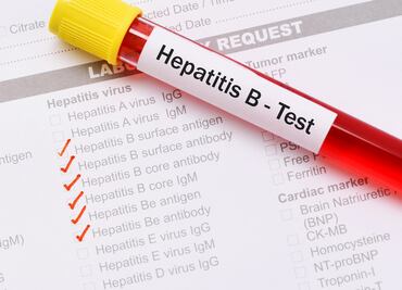 Aumentan los casos de hepatitis B en vecindarios pobres de Nueva York, principalmente