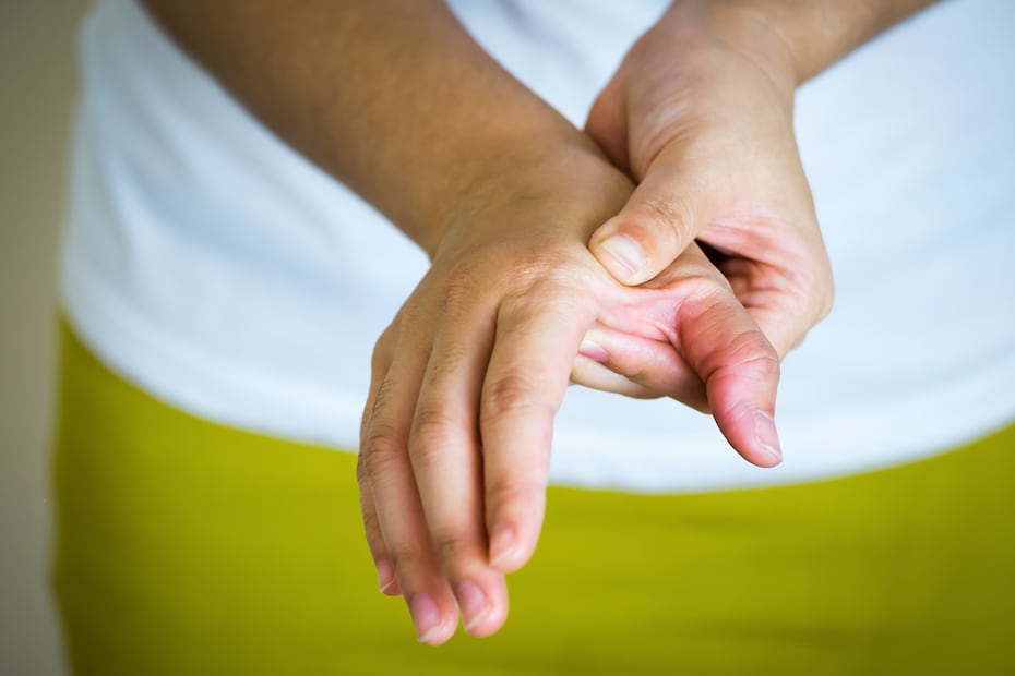 El clavo de olor sí funciona: su compuesto estrella, el eugenol, tiene efectos antiinflamatorios comprobados FOTO: CANVA