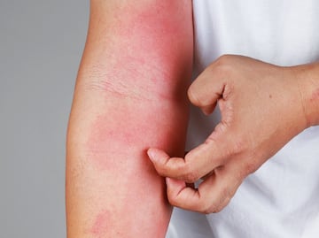 ¿Dolores o comezón en la piel? 10 cosas que el estrés le hace a tu cuerpo