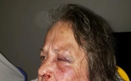 Mujer fractura cráneo a activista que trataba de ayudarla en Texas