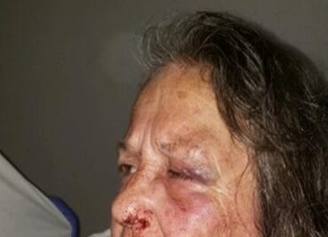 Mujer fractura cráneo a activista que trataba de ayudarla en Texas