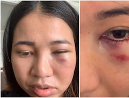 Mujer asiática es brutalmente golpeada en la cara en San Francisco