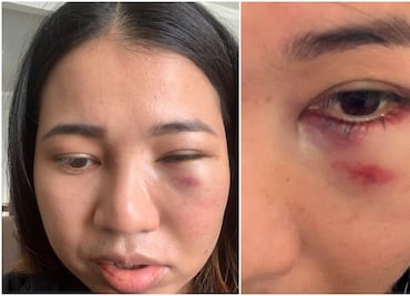 Mujer asiática es brutalmente golpeada en la cara en San Francisco
