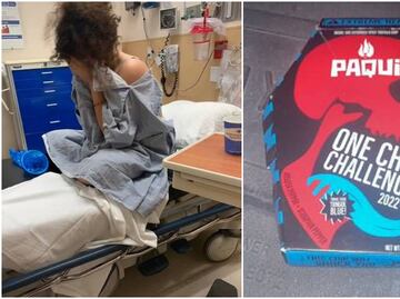 Alertan en EU por reto con totopos picantes que está enviando a jóvenes al hospital