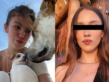¿Cuál es el estado de salud de Valentina Gilabert, modelo apuñalada por Marianne Gonzaga? Esto se sabe