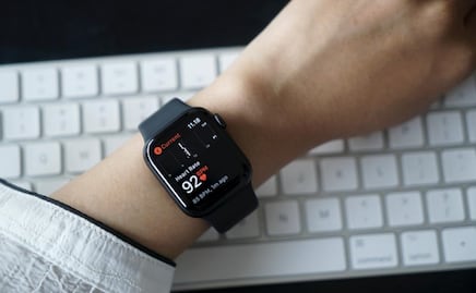 Estos son los alarmantes niveles bacterias que tiene tu Apple Watch