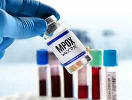 Alertan por viruela del mono más infecciosa: Detectan primeros casos fuera de África