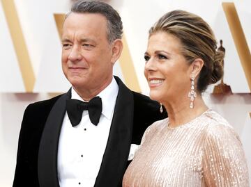 Rita Wilson relata su experiencia con el coronavirus por primera vez