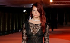 Dua Lipa presume cintura y figura casi irreal con impactante bikini dorado en Francia 