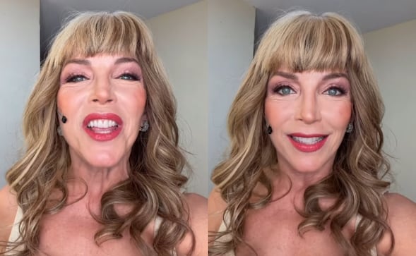 Laura Flores (62 años) impacta con radical cambio de look; redes la critican por ‘exceso’ de cirugías 
