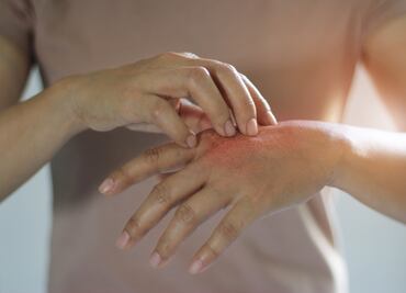 Florida en alerta: Aumentan casos de bacteria 'devoradora de carne'. ¿Qué condados tienen más contagios?